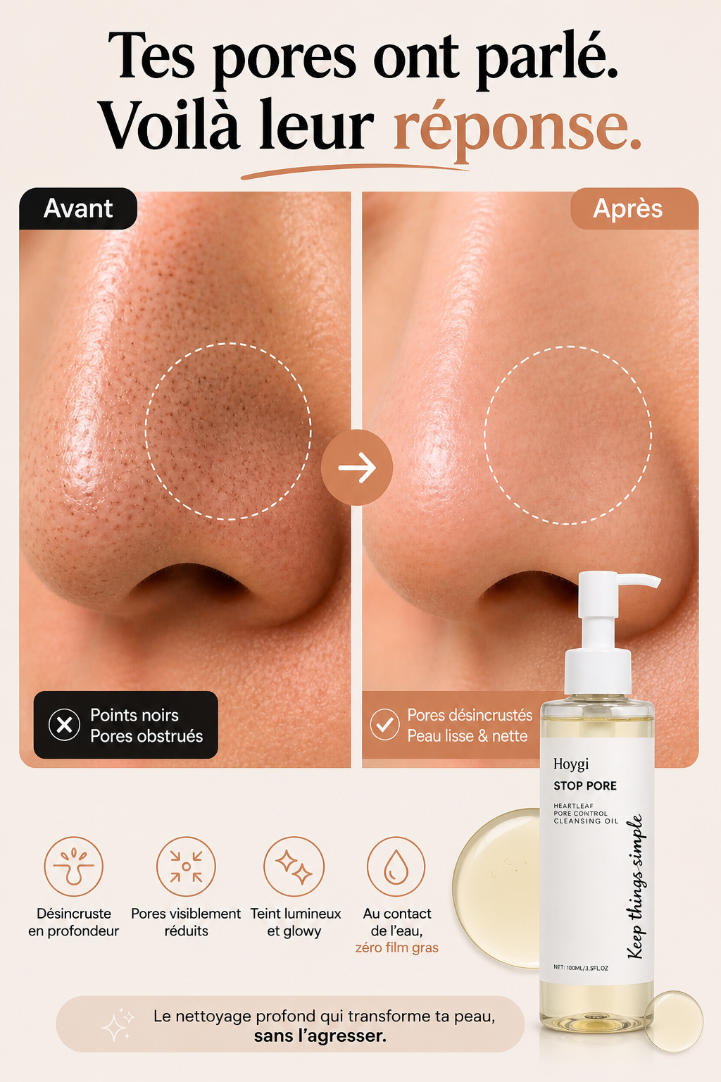 Huile nettoyante Stop Pores